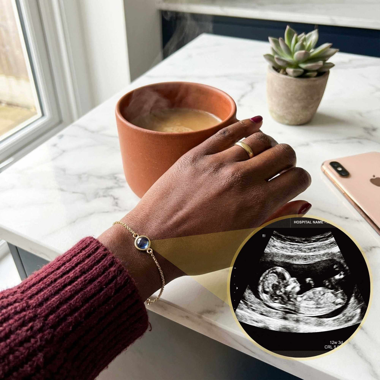 Photo Projection Bracelet showcasing ultrasound image, worn by a mother enjoying coffee, by Brother & Sisters.